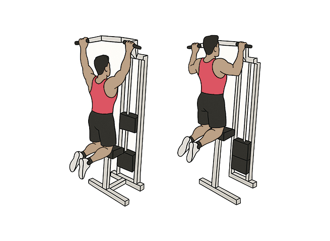 Tractions pronation assistées